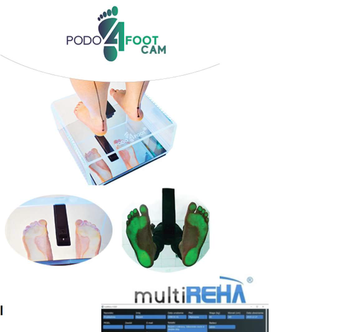 Podoskop s LED svetlom+ HD kamera