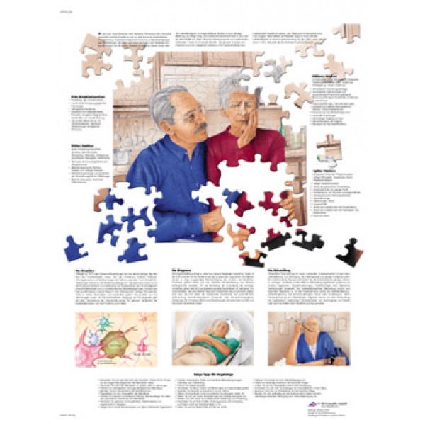 PLAGÁT ALZHEIMER